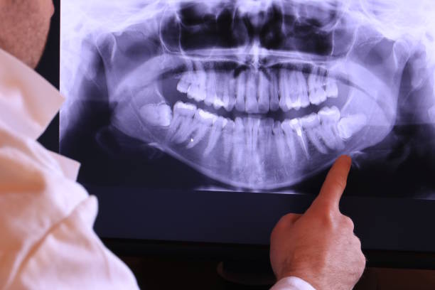 Best Walk-In Emergency Dentist in London, OH