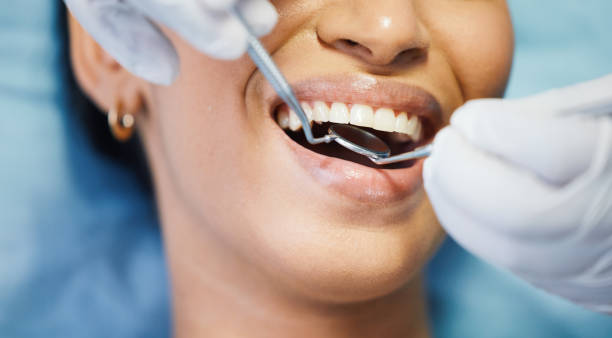 Best Weekend Emergency Dentist in London, OH