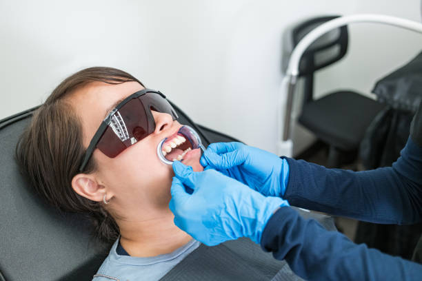 Best Emergency Root Canal Treatment in London, OH